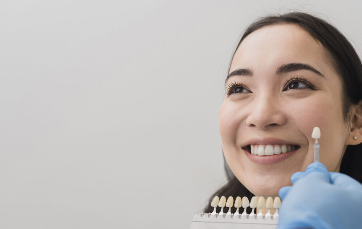 How Long Do Veneers Really Last? Factors That Affect Their Lifespan