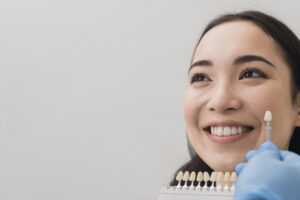 How Long Do Veneers Really Last? Factors That Affect Their Lifespan