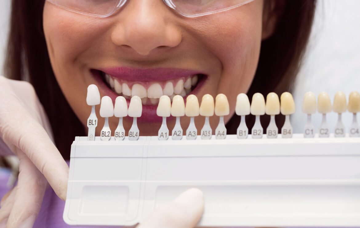 What Patients Should Consider Before Committing to a Veneer Treatment