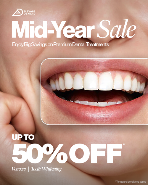Elevate Your Smile with Elevate Dental’s Mid-Year Sale