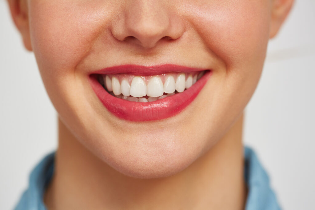 A female face with charming toothy smile after a teeth whitening treatment against white background